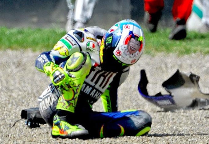 Valentino Rossi Mengalami Kecelakaan Parah, Tulang Tibia dan Fibula Patah