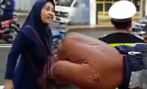 Emak-emak yang Gigit Tangan Polisi di Kudus Jadi Tersangka