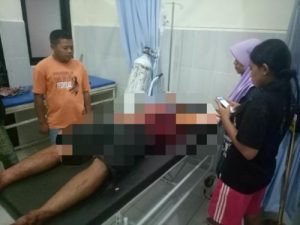 Gara-gara Knalpot Bising, Pemuda Ini Dibacok Tetangganya Sendiri