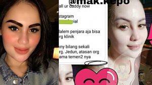 Jennifer Dunn  Panggil Terapis Hingga Lakukan Perawatan Wajah di Penjara, Netizen Heboh!