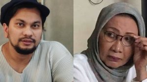 Bukan Dikeroyok, Tompi Ungkap Wajah Babak Belur Ratna Sarumpaet Hasil Operasi Plastik